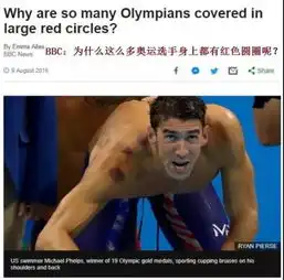 中医朋友圈越来越大外国人有多喜爱中医