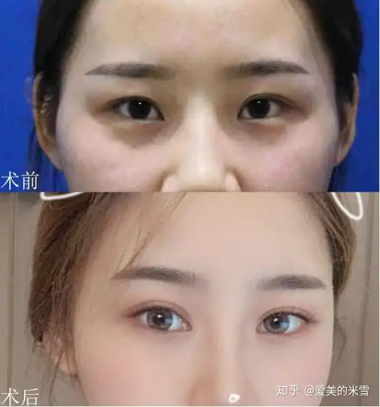 武汉哪里双眼皮做的比较好