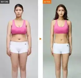 我来告诉你吸脂一次可以减多少脂肪