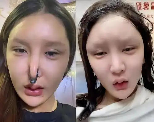 高考后的怪现象,家长排队去民政局,女高中生扎堆做手术