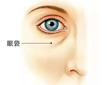这几个坏习惯,更容易导致生长眼袋