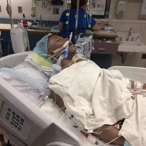 27岁小伙没有心脏却成了健身教练依靠人工心脏让更多人看到希望