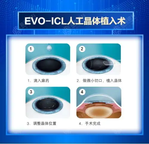暑期摘镜总动员普瑞眼科提醒做近视手术,提前做好这些准备