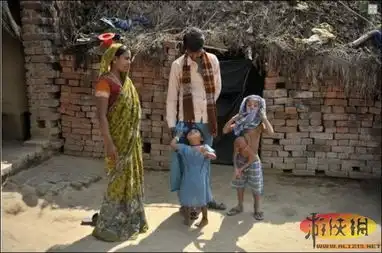 全球最恐怖变异人印度少女血泪难尽