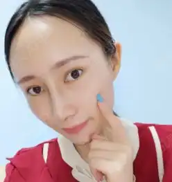 现在的美女真的越来越多了,走在大街上全是长得好看的...鼻综合悦美整形