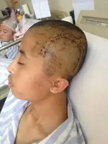 校园暴力,何以斩断延安大学玉章实验中学学生被打致开颅事件的调查
