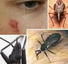 盘点动物界恐怖吸血鬼吸血蝙蝠能力惊人